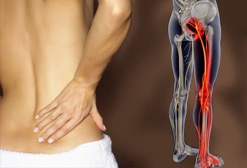 webmd rm photo of lower back pain